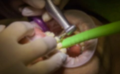 拔牙記作文經(jīng)典(15篇)