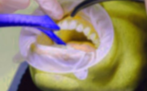 (��(y��u)��)����ӛ����