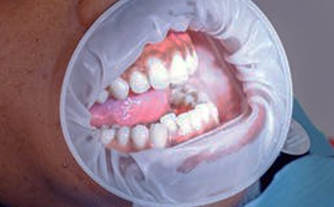 ?���к����l��Ѫ�İY����F(xi��n)