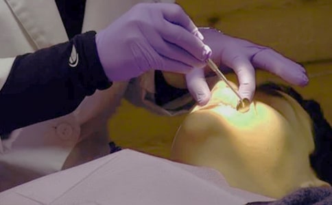 �oʹ΢��(chu��ng)���g(sh��)�����M�������X�γ��g(sh��)�е��R����(y��ng)��