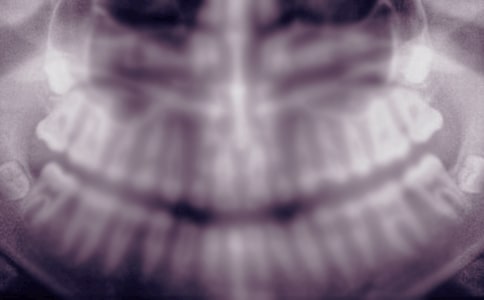 ��������X���׺ðΆ�